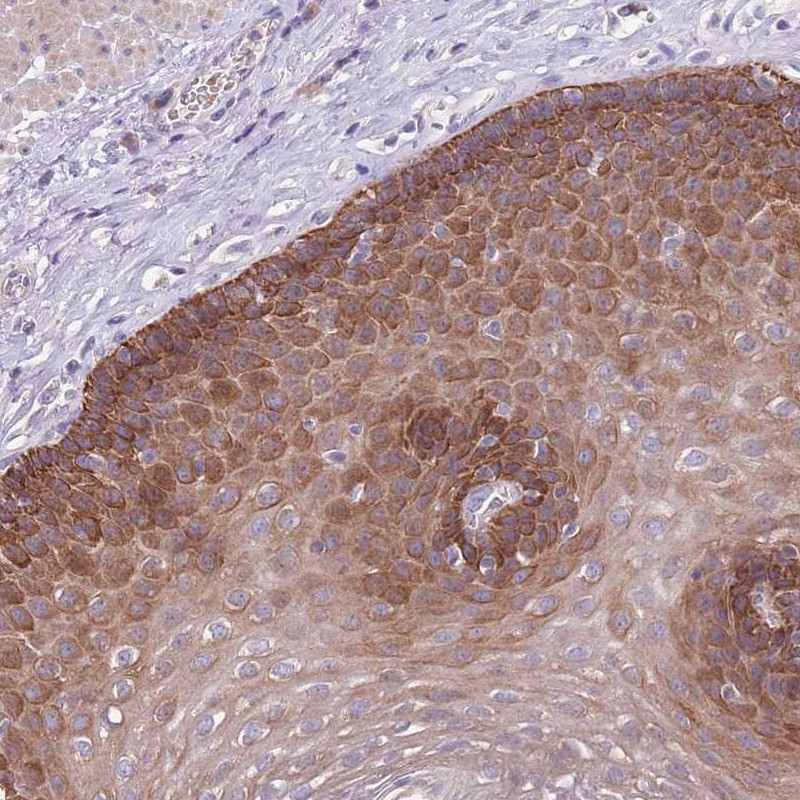 Anti-ZNF658 Antibody