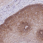 Anti-ZNF658 Antibody