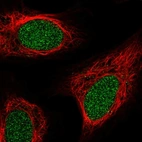 Immunofluorescent staining of human cell line U-2 OS shows localization to nucleoplasm.