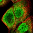 Immunofluorescent staining of human cell line A-431 shows localization to nucleoplasm & cytosol.