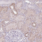 Anti-OR6M1 Antibody
