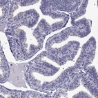 Immunohistochemical staining of human fallopian tube shows high expression.
