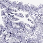 Immunohistochemical staining of human prostate shows low expression as expected.