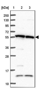 Lane 1: Marker [kDa] 250, 130, 95, 72, 55, 36, 28, 17, 10_br/_Lane 2: Human cell line RT-4_br/_Lane 3: Human cell line U-251MG sp