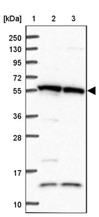 Lane 1: Marker [kDa] 250, 130, 95, 72, 55, 36, 28, 17, 10_br/_Lane 2: Human cell line RT-4_br/_Lane 3: Human cell line U-251MG sp