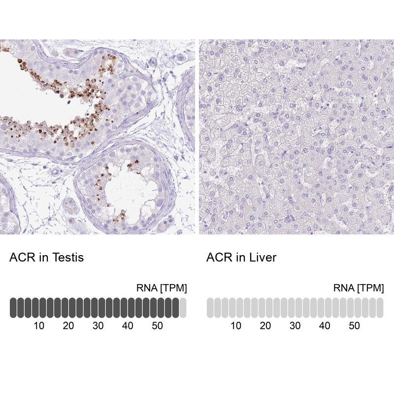 Anti-ACR Antibody
