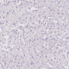 Immunohistochemical staining of human liver shows no positivity in hepatocytes as expected.