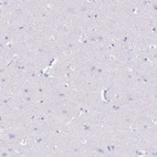 Immunohistochemical staining of human cerebral cortex shows no positivity in neurons as expected.