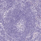 Immunohistochemical staining of human lymph node shows no positivity in germinal center cells as expected.