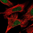 Immunofluorescent staining of human cell line U-2 OS shows localization to nucleus.
