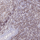 Anti-HMGN1 Antibody