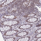 Immunohistochemical staining of human colon shows moderate nuclear positivity in glandular cells and lymphoid cells.