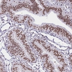 Immunohistochemical staining of human fallopian tube shows strong nuclear positivity in glandular cells.