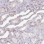 Immunohistochemical staining of human kidney shows moderate nuclear positivity in cells in tubules.