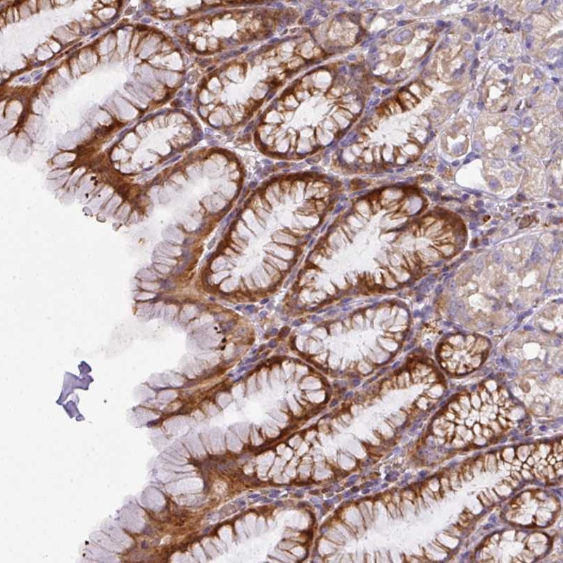 Anti-ATP6V1F Antibody