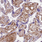 Anti-TINAGL1 Antibody