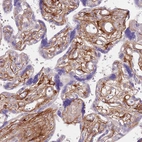 Anti-TINAGL1 Antibody