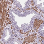 Immunohistochemical staining of human prostate shows strong cytoplasmic positivity in smooth muscle cells.