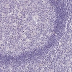 Immunohistochemical staining of human lymph node shows no positivity in germinal center cells as expected.