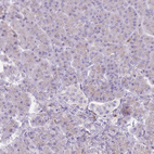 Anti-TINAGL1 Antibody