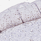 Immunohistochemical staining of human cervix, uterine shows moderate nuclear positivity in squamous epithelial cells.