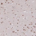 Immunohistochemical staining of human cerebral cortex shows strong nuclear positivity in neurons.