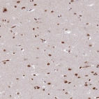 Immunohistochemical staining of human cerebral cortex shows strong nuclear positivity in neurons.