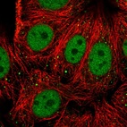 Immunofluorescent staining of human cell line MCF7 shows localization to nucleoplasm & vesicles.