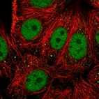 Immunofluorescent staining of human cell line MCF7 shows localization to nucleoplasm & vesicles.