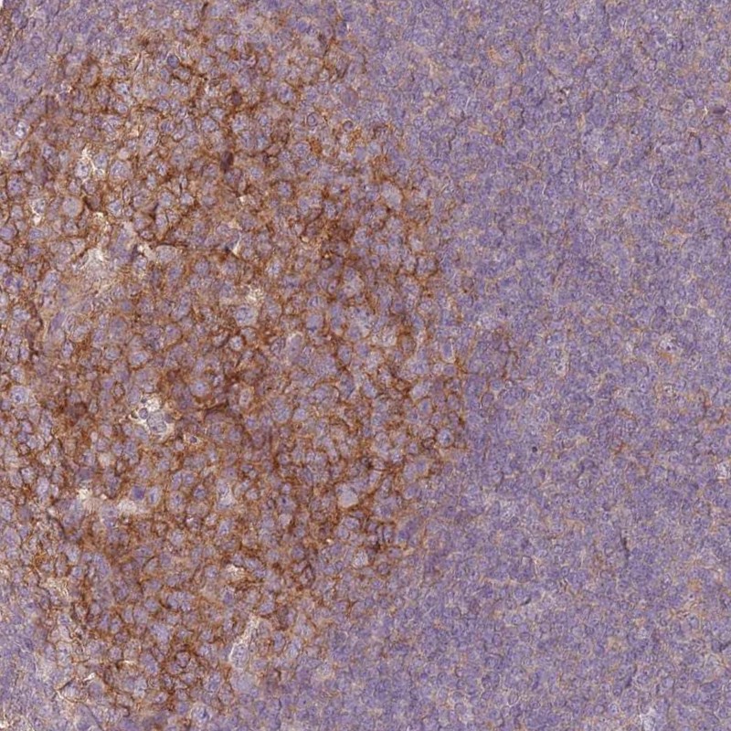 Anti-RFTN1 Antibody