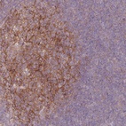 Anti-RFTN1 Antibody