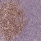 Anti-RFTN1 Antibody