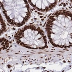 Immunohistochemical staining of human colon using Anti-HDGF antibody HPA048728.