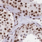Immunohistochemical staining of human testis using Anti-HDGF antibody HPA048728.