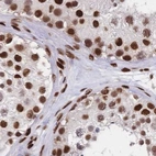 Immunohistochemical staining of human testis using Anti-HDGF antibody HPA048728.