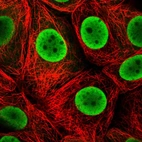 Immunofluorescent staining of human cell line MCF7 shows localization to nucleoplasm.