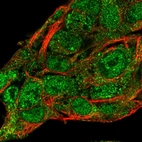 Immunofluorescent staining of human cell line Hep G2 shows localization to nucleoplasm & cytosol.