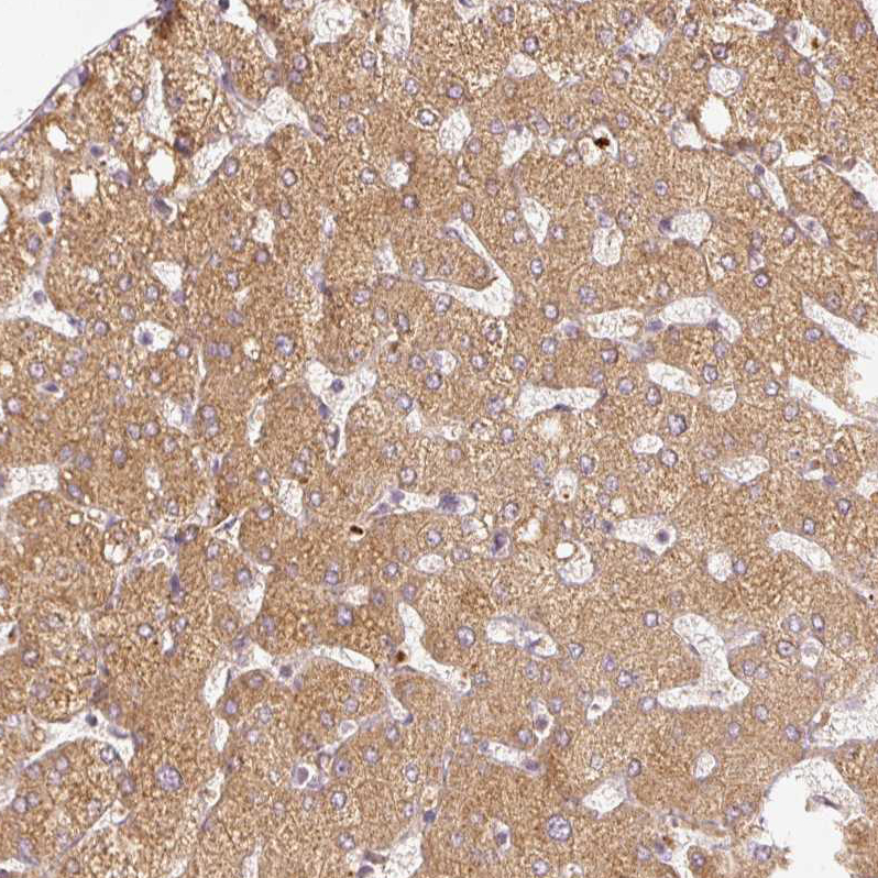 Anti-SERPING1 Antibody