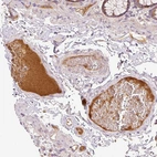 Immunohistochemical staining of human colon shows moderate positivity in plasma.
