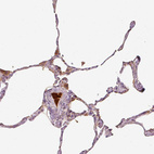 Immunohistochemical staining of human lung shows strong positivity in plasma.