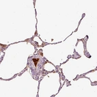 Immunohistochemical staining of human lung shows strong positivity in plasma.