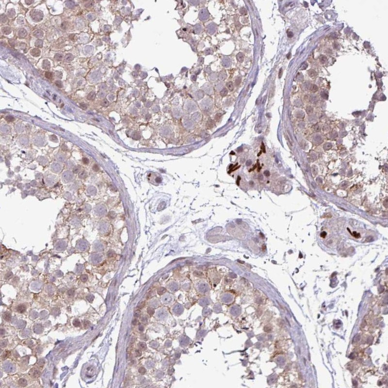 Anti-NOTCH2 Antibody
