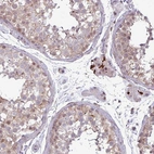 Anti-NOTCH2 Antibody
