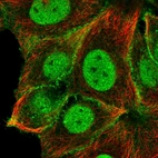 Immunofluorescent staining of human cell line MCF7 shows localization to nucleoplasm & plasma membrane.