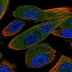 Immunofluorescent staining of human cell line PC-3 shows localization to cytosol.