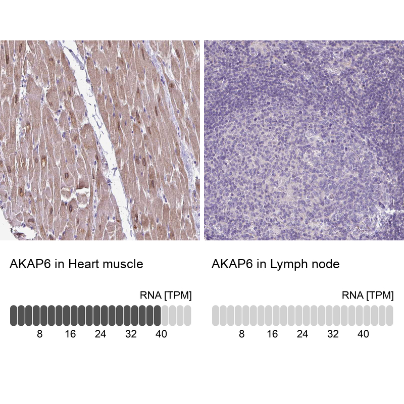 Anti-AKAP6 Antibody