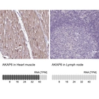 Anti-AKAP6 Antibody