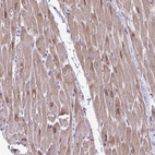 Immunohistochemical staining of human heart muscle shows moderate positivity in nuclear membrane in cardiomyocytes.