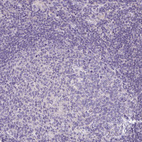 Immunohistochemical staining of human lymph node shows no positivity in germinal center cells as expected.