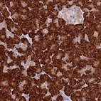 Anti-RPS9 Antibody